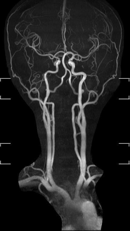 MRI: Producing images of the human body