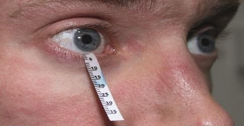 Dry Eye Diagnose Test